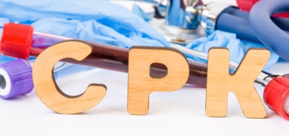 בדיקת קראטין פוספוקינאז (Creatine Kinase - CPK) - תמונה